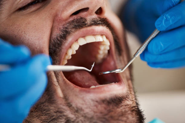 Best Broken or Cracked Tooth Emergency Dentist in Lakeview, NY
